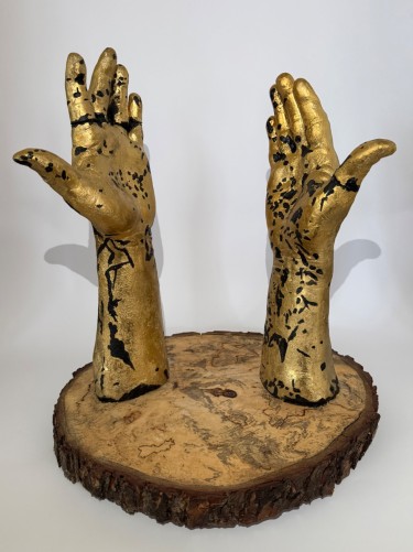 VITILIGO